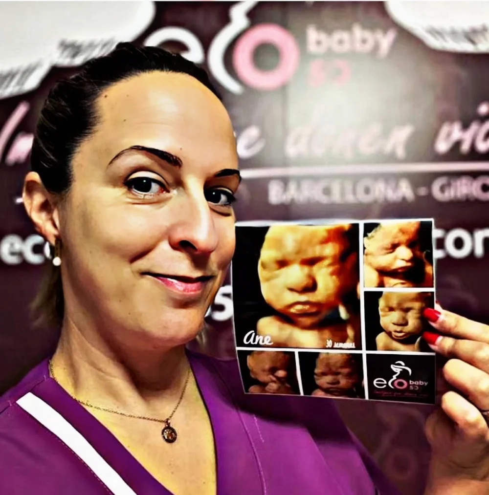 Ecografía 5D Barcelona, Eco Baby Centro de Ecografías 5D